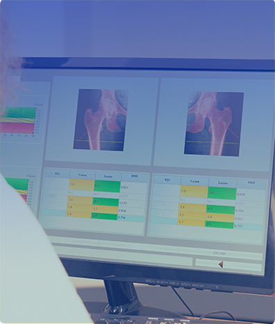 DENSITOMETRIA COLUMNA LUMBAR Y ANTEBRAZO DUAL