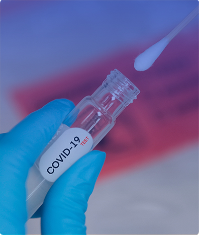 DETECCIÓN DEL CORONAVIRUS (PRUEBA COVID-19 POR PCR)