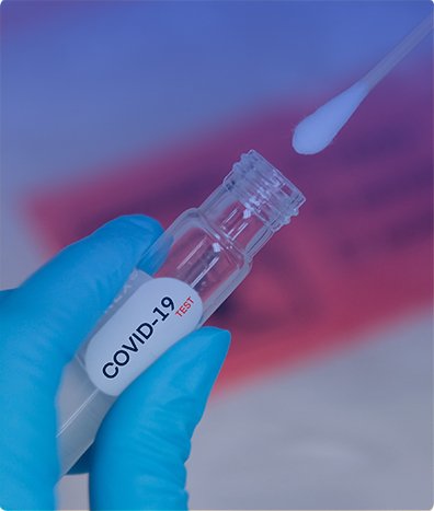 PRUEBA RÁPIDA ANTÍGENO SARS-COV-2 (COVID-19) PÚBLICO GENERAL