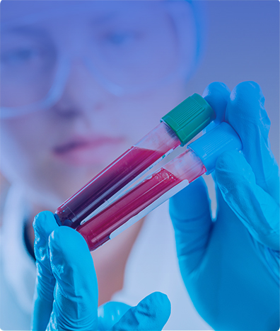 TUBERCULOSIS EN SANGRE POR PCR