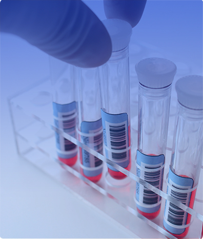 CITOMEGALOVIRUS POR PCR